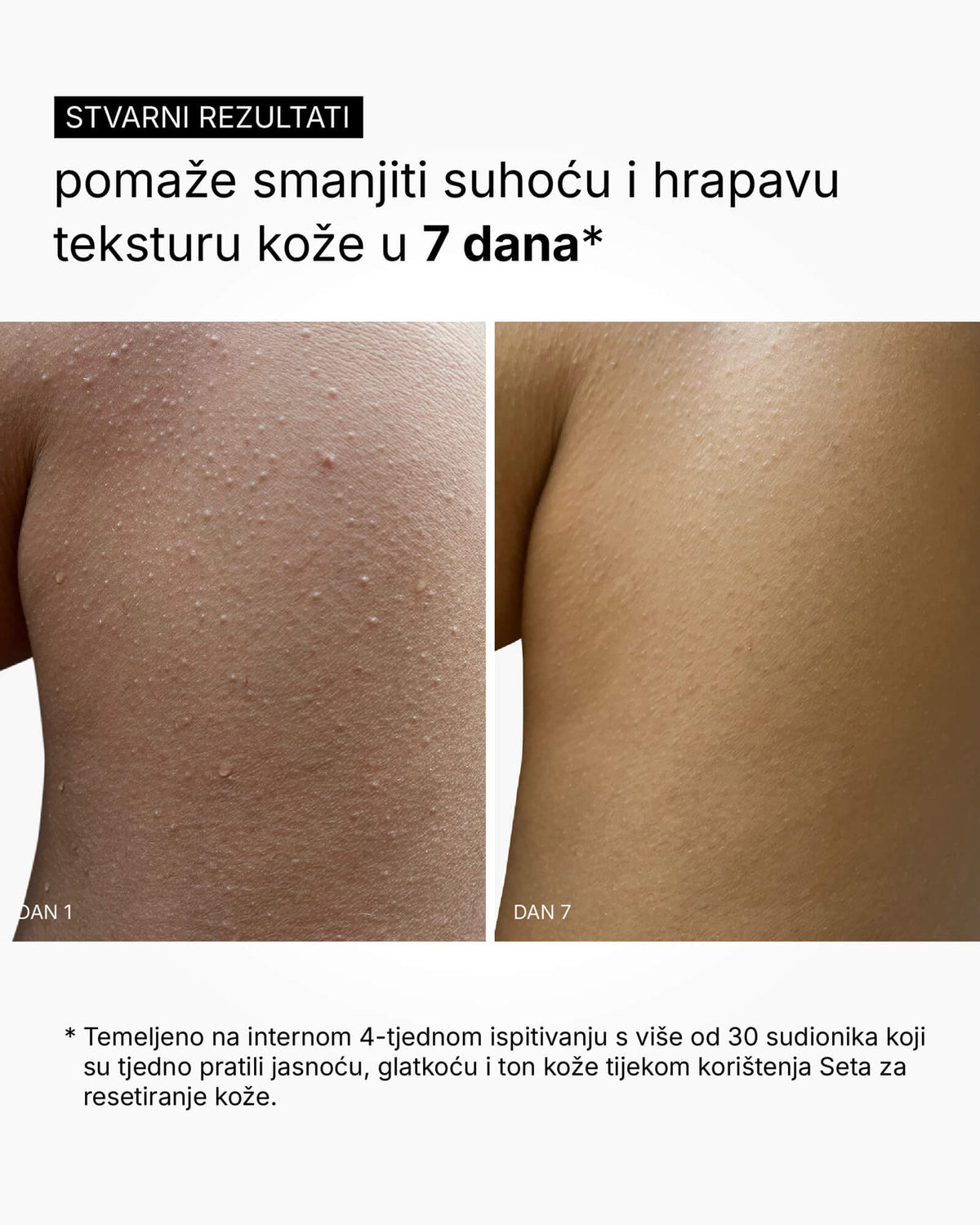 Skin Reset Set - Full Body Routine